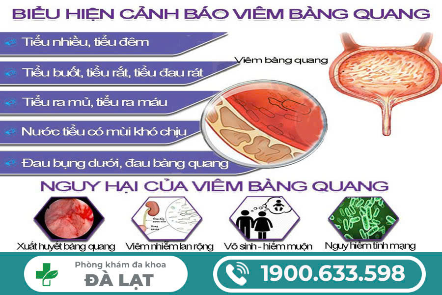 Hình ảnh minh họa